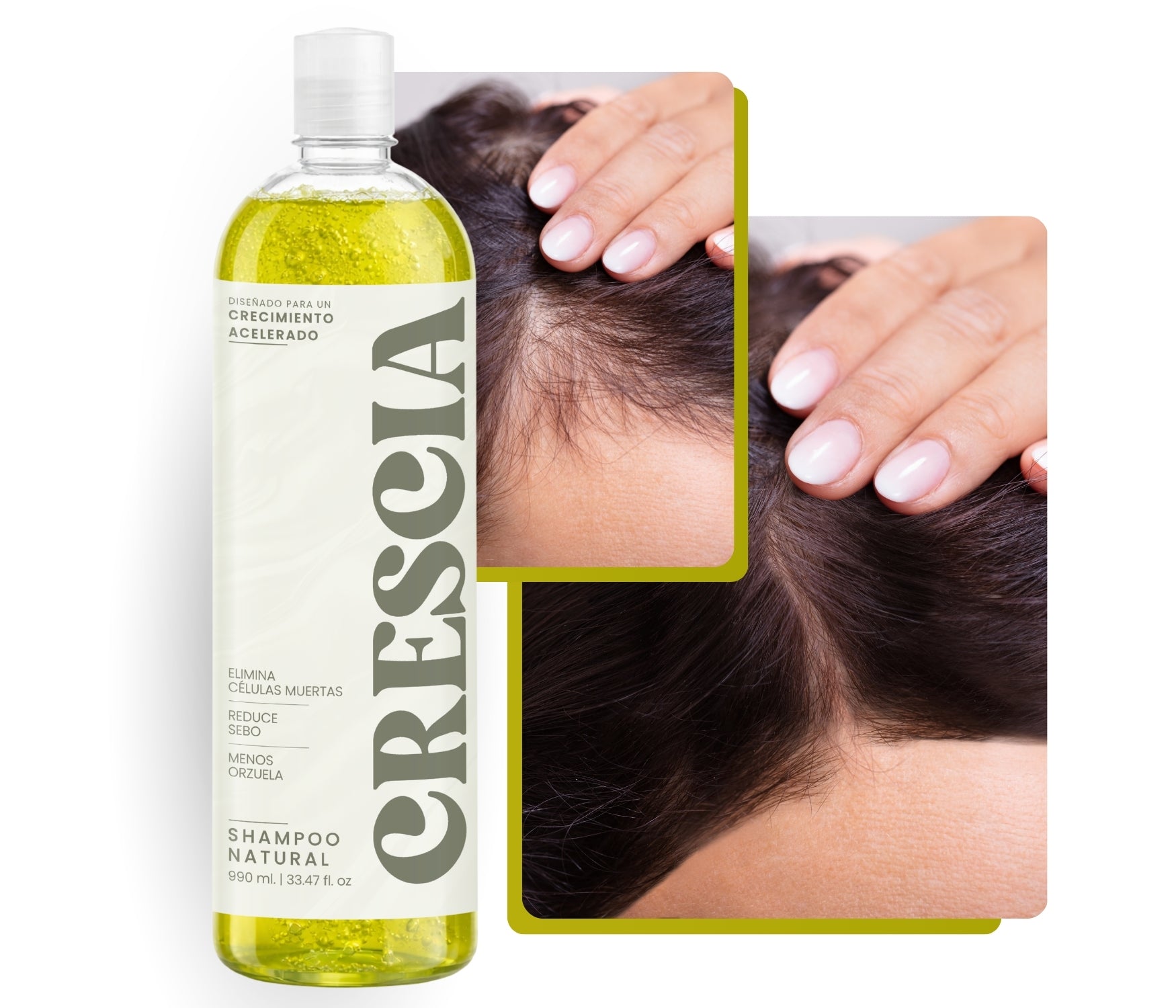 Shampoo Crescia 990ml. | Crecimiento Acelerado del Cabello, Anticaída Potente, Regeneración Capilar, Cabello Más Largo, Fuerte y Abundante desde la Raíz