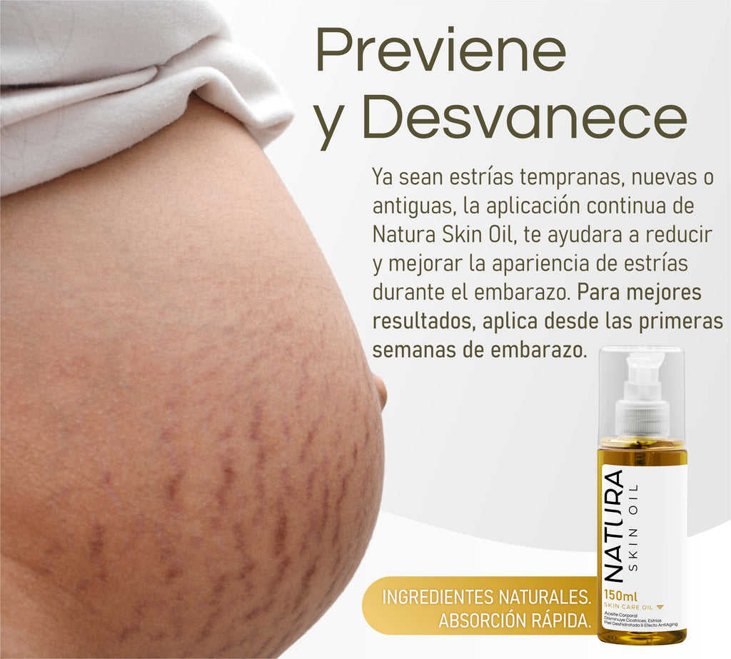 Natura Skin Oil 150ml. | Aceite Corporal Reduce Estrías y Cicatrices, Hidrata Profundamente y Mejora la Elasticidad de la Piel