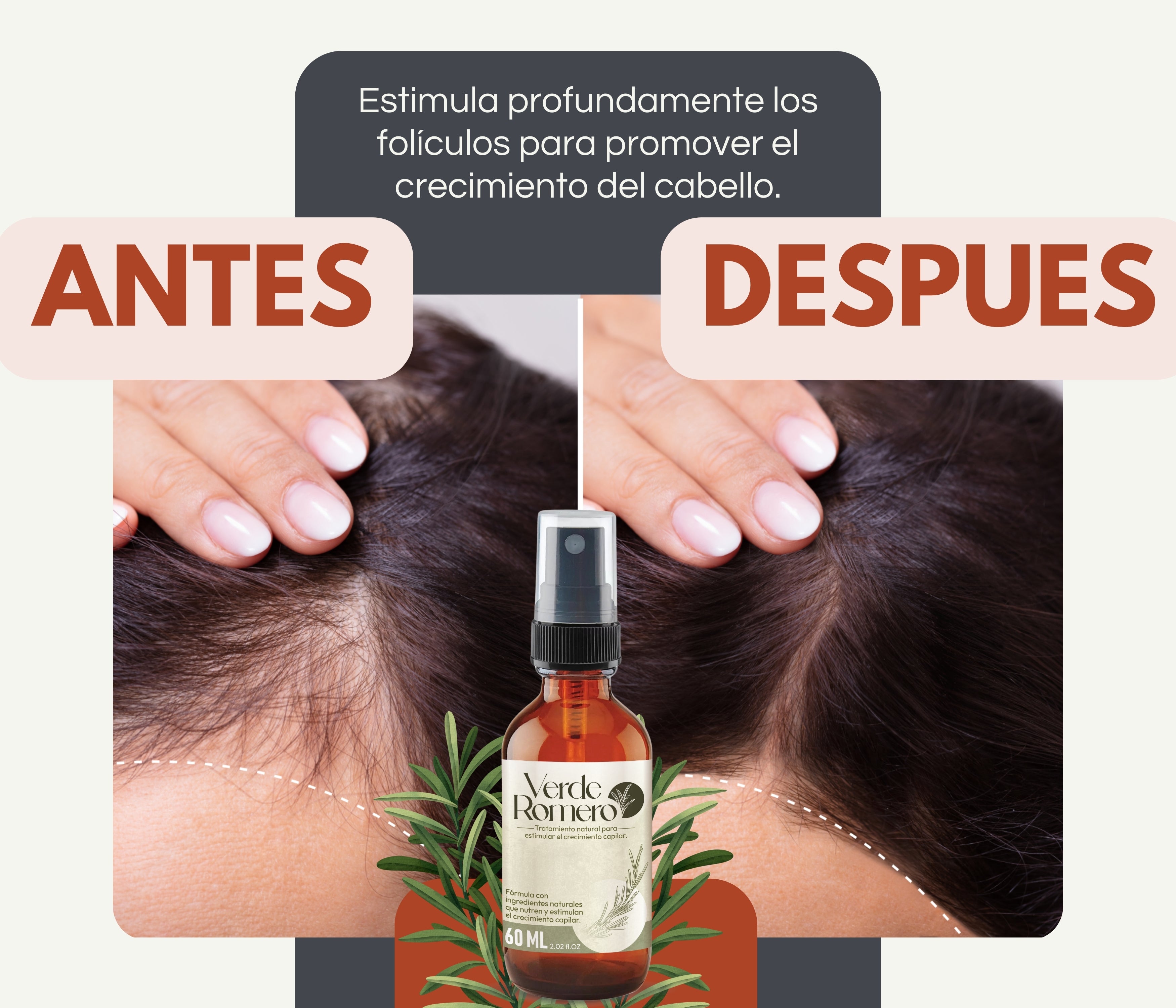 Verde Romero 60ml | Spray Capilar para Crecimiento, Anticaída y Cabello Más Fuerte