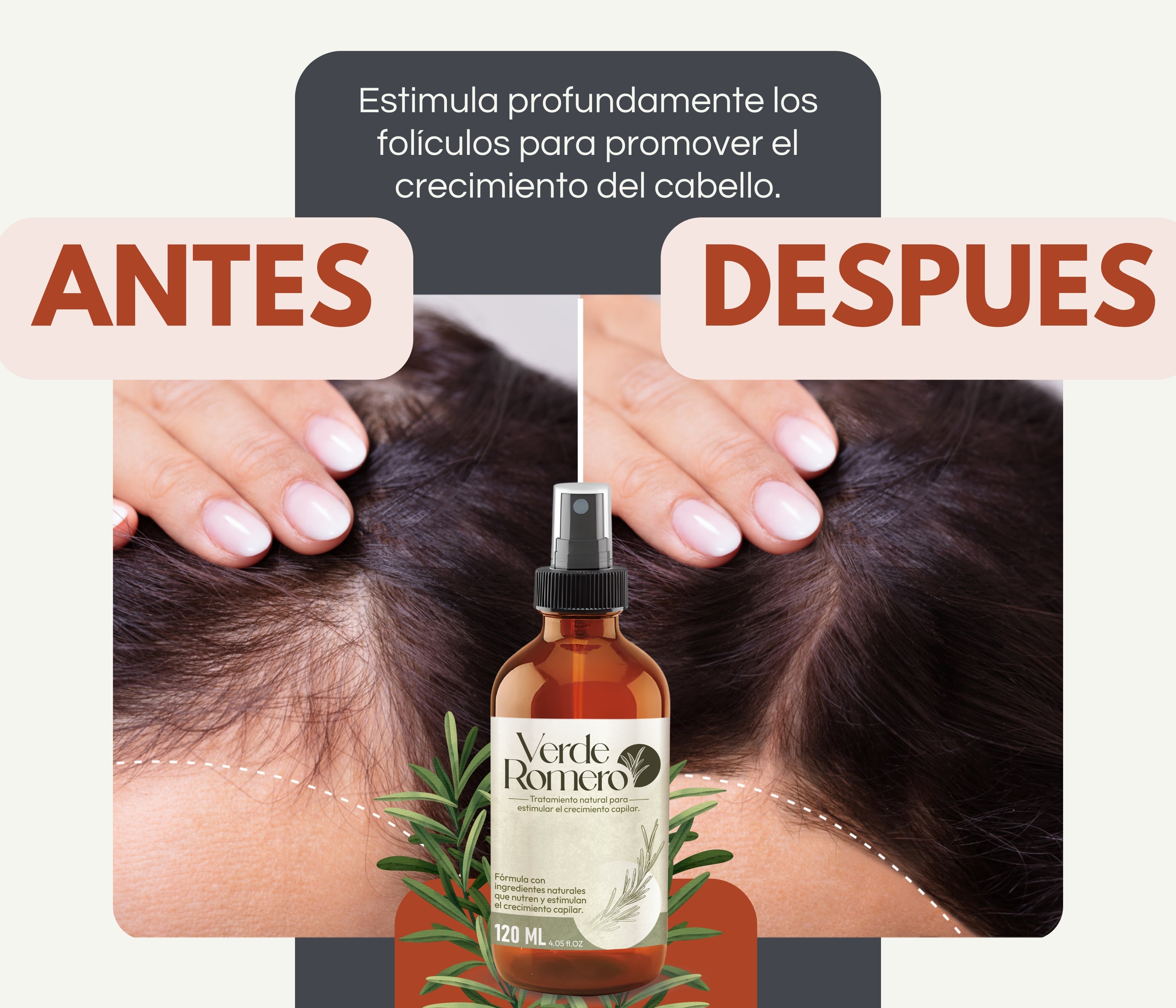 Verde Romero 120ml | Spray Capilar para Crecimiento, Anticaída y Cabello Más Fuerte