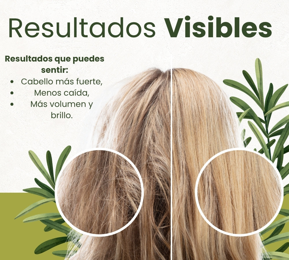 Verde Romero Shampoo 490ml. | Estimula el Crecimiento, Reduce la Caída y Fortalece el Cabello desde la Raíz