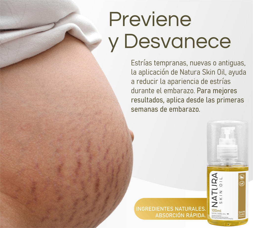 Natura Skin Oil 100ml. | Aceite Corporal Reduce Estrías y Cicatrices, Hidrata Profundamente y Mejora la Elasticidad de la Piel